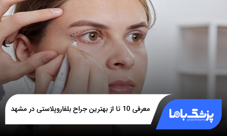 بهترین جراح بلفاروپلاستی در مشهد