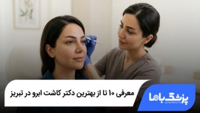 بهترین دکتر کاشت ابرو در تبریز