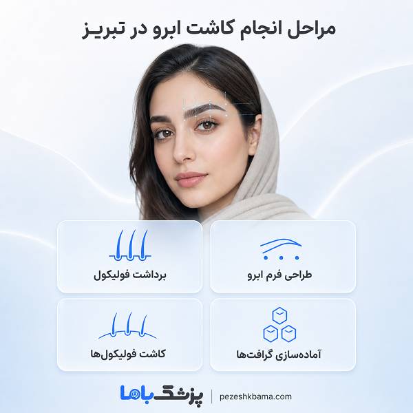 مراحل انجام کاشت ابرو در تبریز