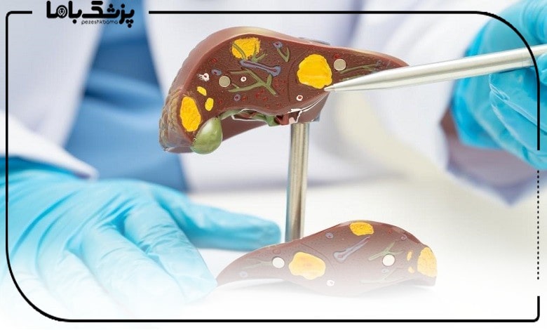 اقدامات بهترین دکتر کبد چرب در اصفهان برای درمان بیماران