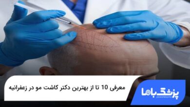 بهترین دکتر کاشت مو در زعفرانیه