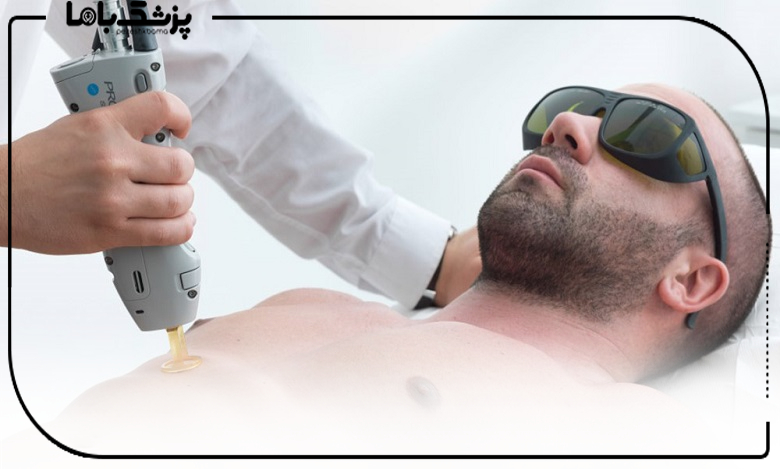 تعرفه خدمات بهترین کلینیک لیزر آقایان در کرج