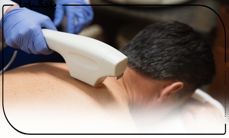 هزینه خدمات بهترین کلینیک لیزر آقایان در شیراز