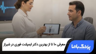 بهترین دکتر ایمپلنت فوری در شیراز