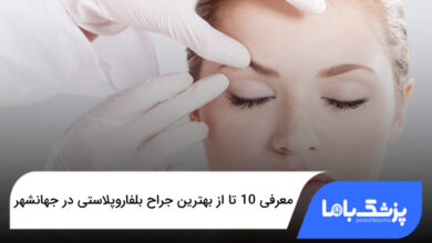 بهترین جراح بلفاروپلاستی در جهانشهر