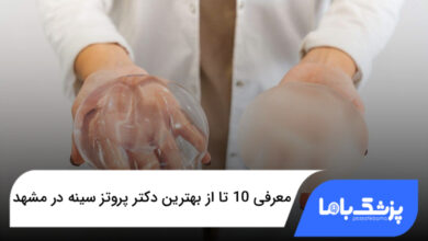 بهترین دکتر پروتز سینه در مشهد