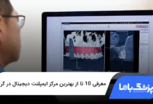 بهترین مرکز ایمپلنت دیجیتال در کرج