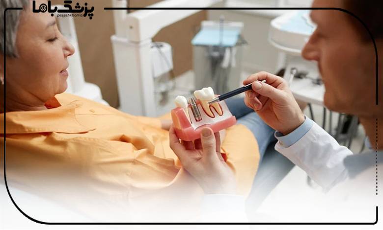 مشاوره دکتر ایمپلنت دیجیتال در شیراز
