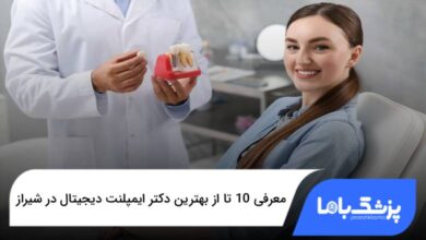 بهترین دکتر ایمپلنت دیجیتال در شیراز