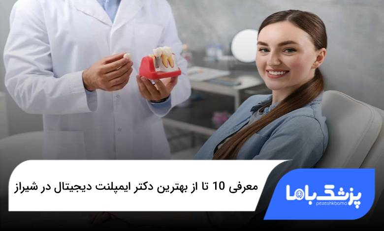 بهترین دکتر ایمپلنت دیجیتال در شیراز