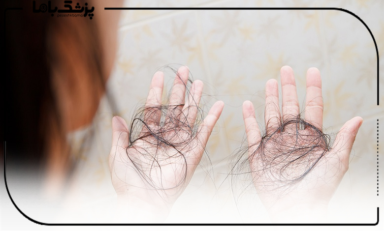 هزینه خدمات بهترین دکتر درمان ریزش مو با سلول بنیادی در ایران