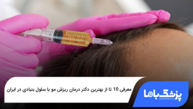 بهترین دکتر درمان ریزش مو با سلول بنیادی در ایران