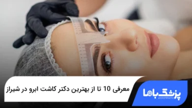بهترین دکتر کاشت ابرو در شیراز
