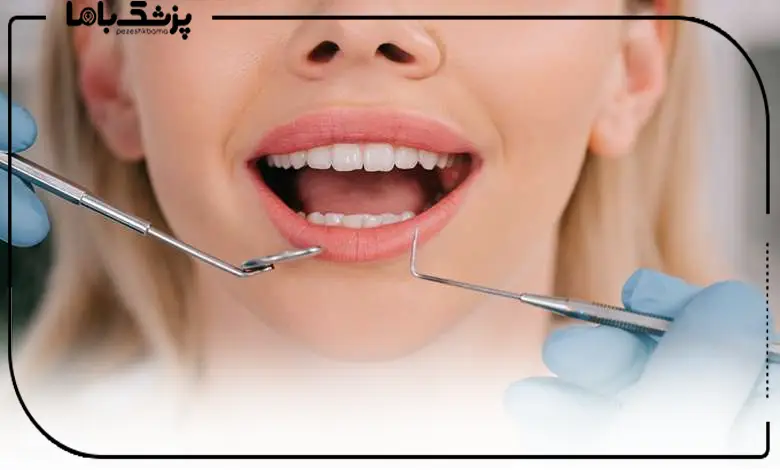 روشهای تشخیصی برای درمان بیماریهای لثه