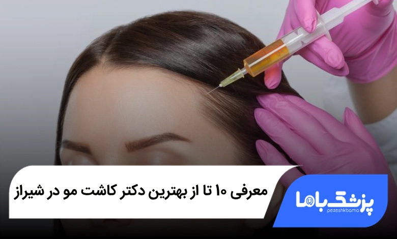 بهترین دکتر کاشت مو در شیراز