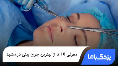 بهترین جراح بینی در مشهد