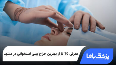 بهترین جراح بینی استخوانی در مشهد