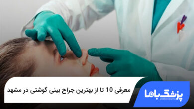 بهترین جراح بینی گوشتی در مشهد