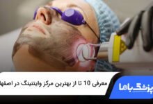 بهترین مرکز وایتنینگ در اصفهان