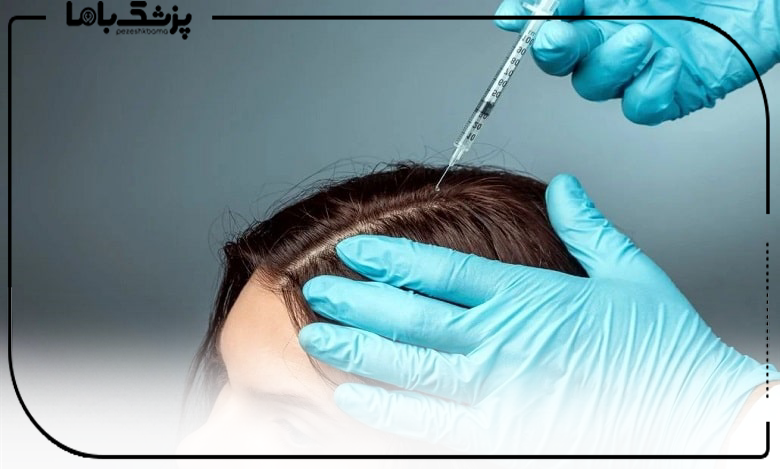 تزریق سلول بنیادی اتولوگ استخراج شده با دستگاه ICELL یا GCELL