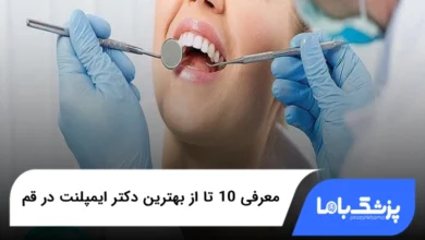بهترین دکتر ایمپلنت در قم