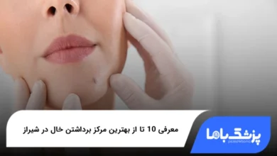 بهترین مرکز برداشتن خال در شیراز