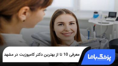 بهترین دکتر کامپوزیت در مشهد