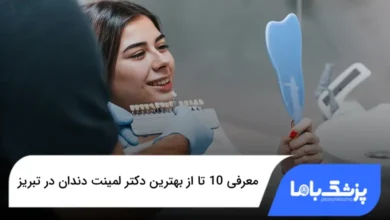 بهترین دکتر لمینت دندان در تبریز