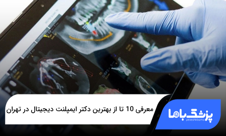 بهترین دکتر ایمپلنت دیجیتال در تهران