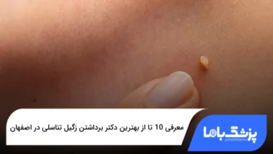 بهترین دکتر برداشتن زگیل تناسلی در اصفهان