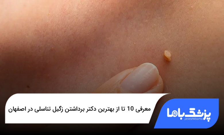 بهترین دکتر برداشتن زگیل تناسلی در اصفهان