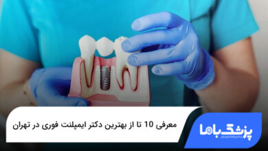 بهترین دکتر ایمپلنت فوری در تهران