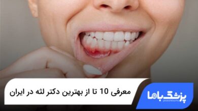 بهترین دکتر لثه در ایران