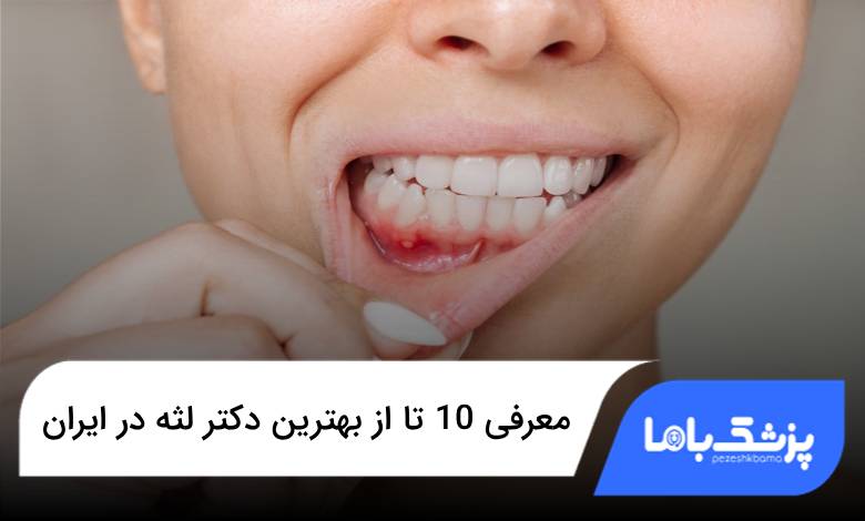 بهترین دکتر لثه در ایران