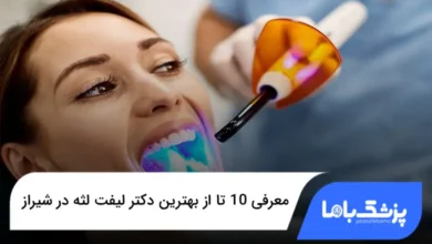 بهترین دکتر لیفت لثه در شیراز
