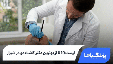 بهترین دکتر کاشت مو در شیراز