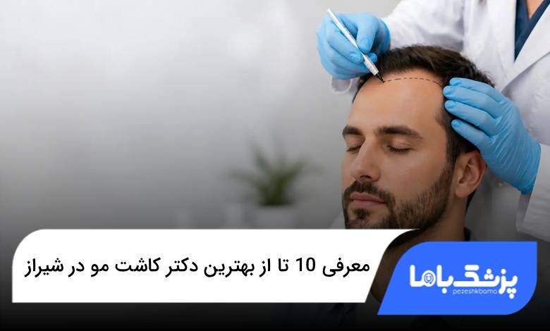 بهترین دکتر کاشت مو در شیراز