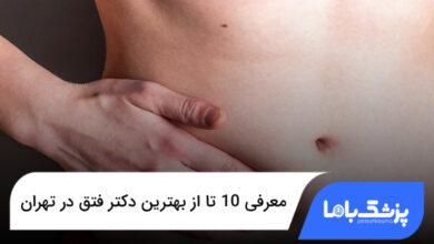 بهترین دکتر فتق در تهران