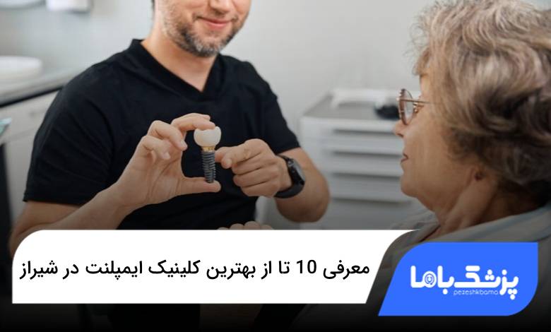 بهترین کلینیک ایمپلنت در شیراز