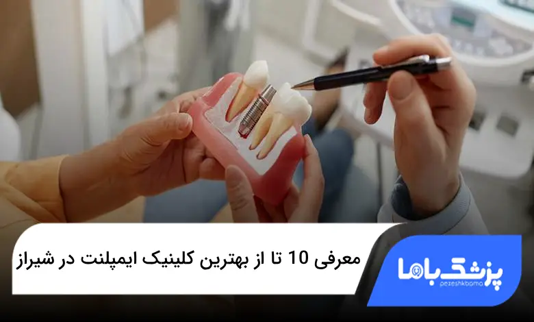 بهترین کلینیک ایمپلنت در شیراز
