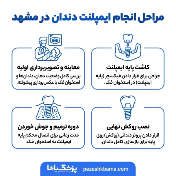 مراحل انجام ایمپلنت دندان در مشهد