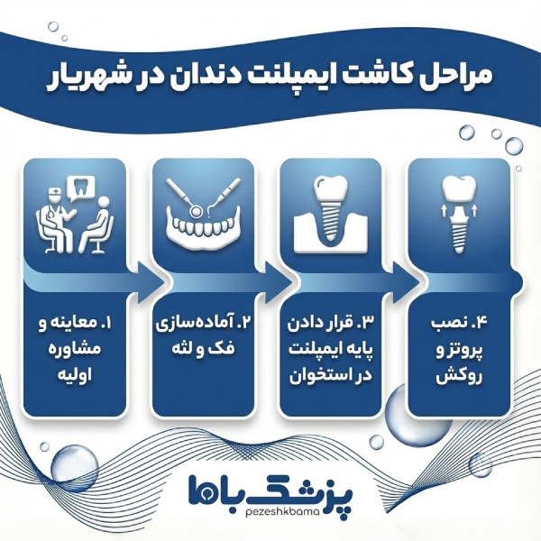 بهترین دکتر ایمپلنت در شهریار