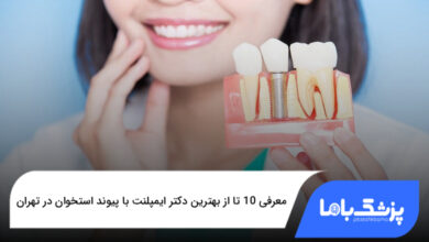 بهترین دکتر ایمپلنت با پیوند استخوان در تهران