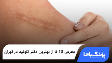 بهترین دکتر کلوئید در تهران