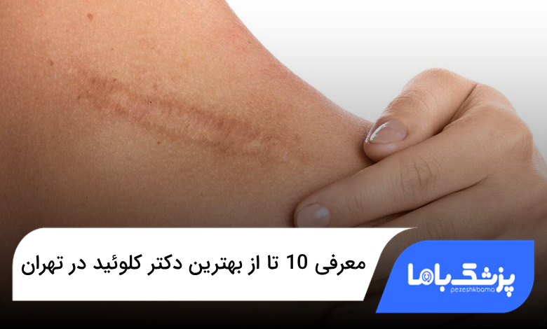 بهترین دکتر کلوئید در تهران