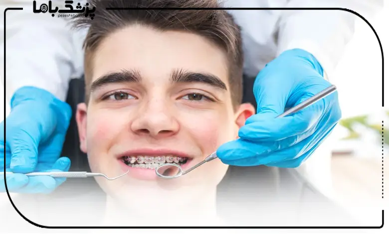 علت تفاوت قیمت ارتودنسی در تبریز چیست؟