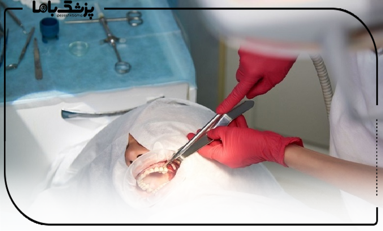 مراقبتهای بعد از جراحی سینوس لیفت