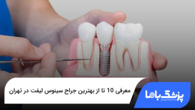 بهترین جراح سینوس لیفت در تهران