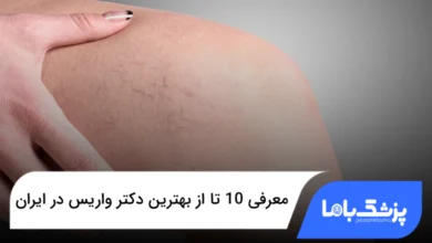 بهترین دکتر واریس در ایران