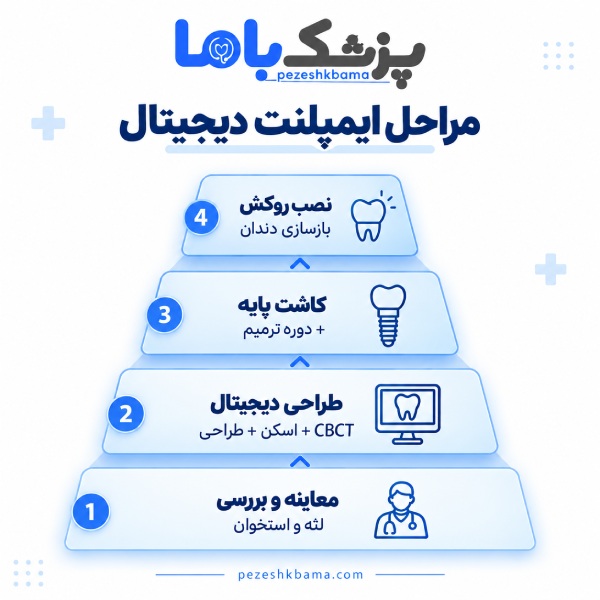 مراحل ایمپلنت دیجیتال